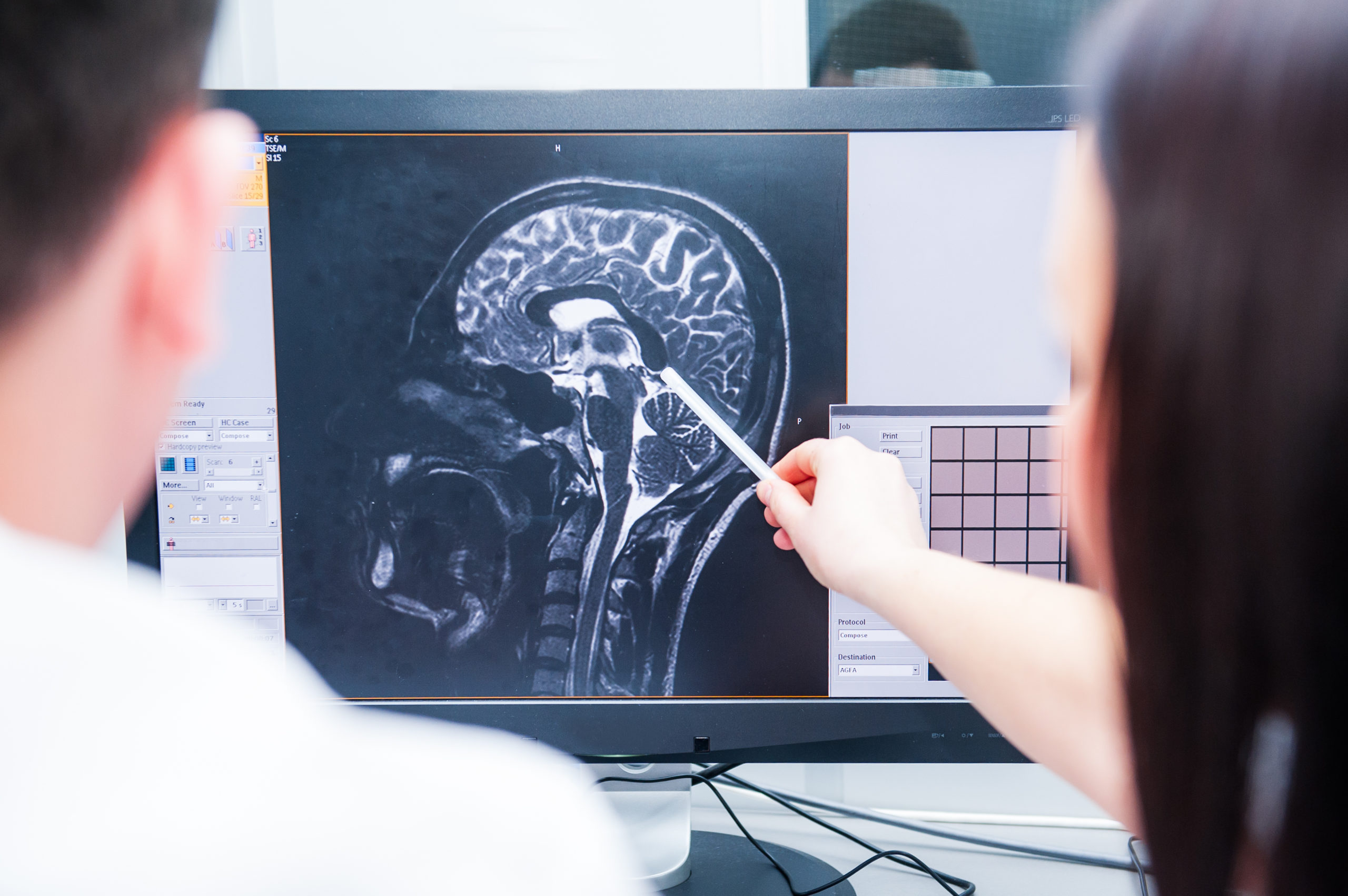 Motor Vehicle Accident Leaves Comedian with Brain Injury
